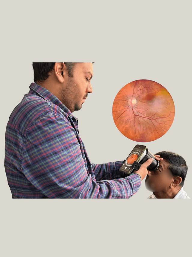 Ocellux: Eye Screening Anywhere image