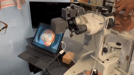 SLIT PAL: Digitize Any Slit Lamp image