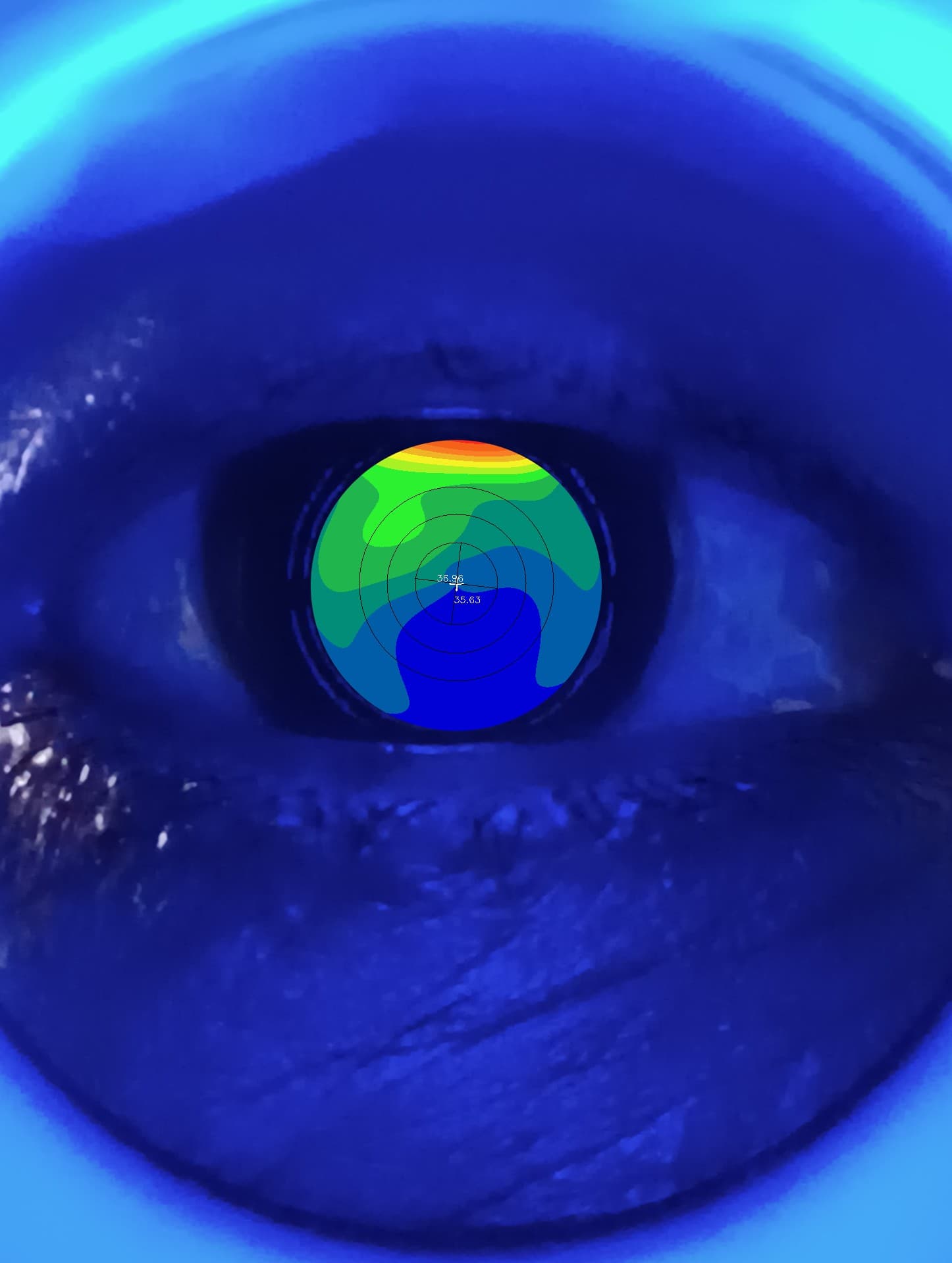 OcelluxKC: Portable Corneal Topographer image